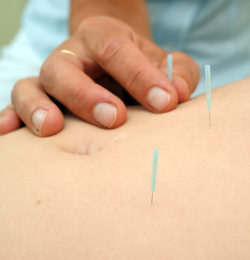 Leistungen Akupunktur
